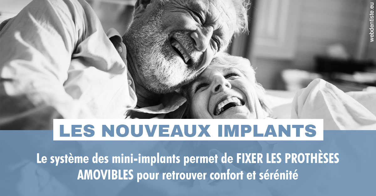 https://www.docteur-lamoureux-jean-claude.fr/Les nouveaux implants 2