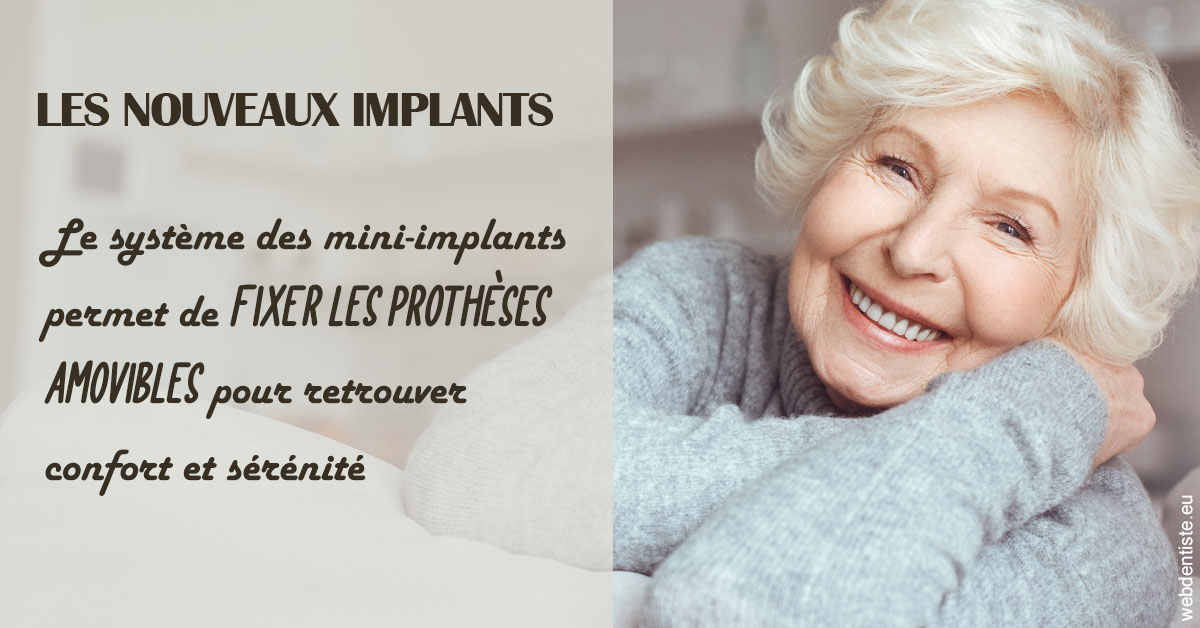https://www.docteur-lamoureux-jean-claude.fr/Les nouveaux implants 1
