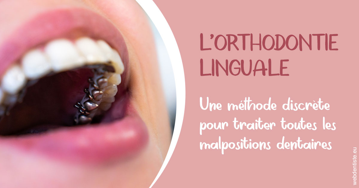 https://www.docteur-lamoureux-jean-claude.fr/L'orthodontie linguale 2