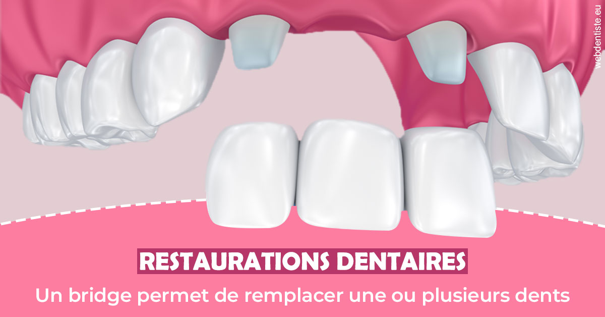 https://www.docteur-lamoureux-jean-claude.fr/Bridge remplacer dents 2