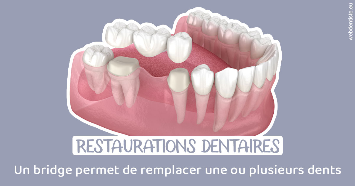 https://www.docteur-lamoureux-jean-claude.fr/Bridge remplacer dents 1