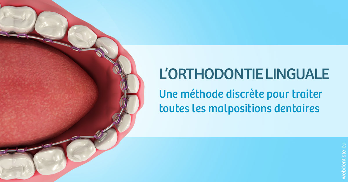 https://www.docteur-lamoureux-jean-claude.fr/L'orthodontie linguale 1