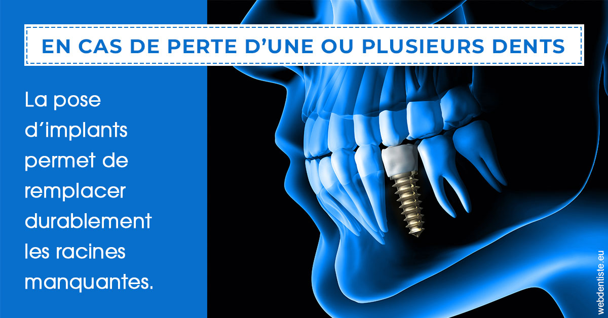 https://www.docteur-lamoureux-jean-claude.fr/2024 T1 - Implants 01