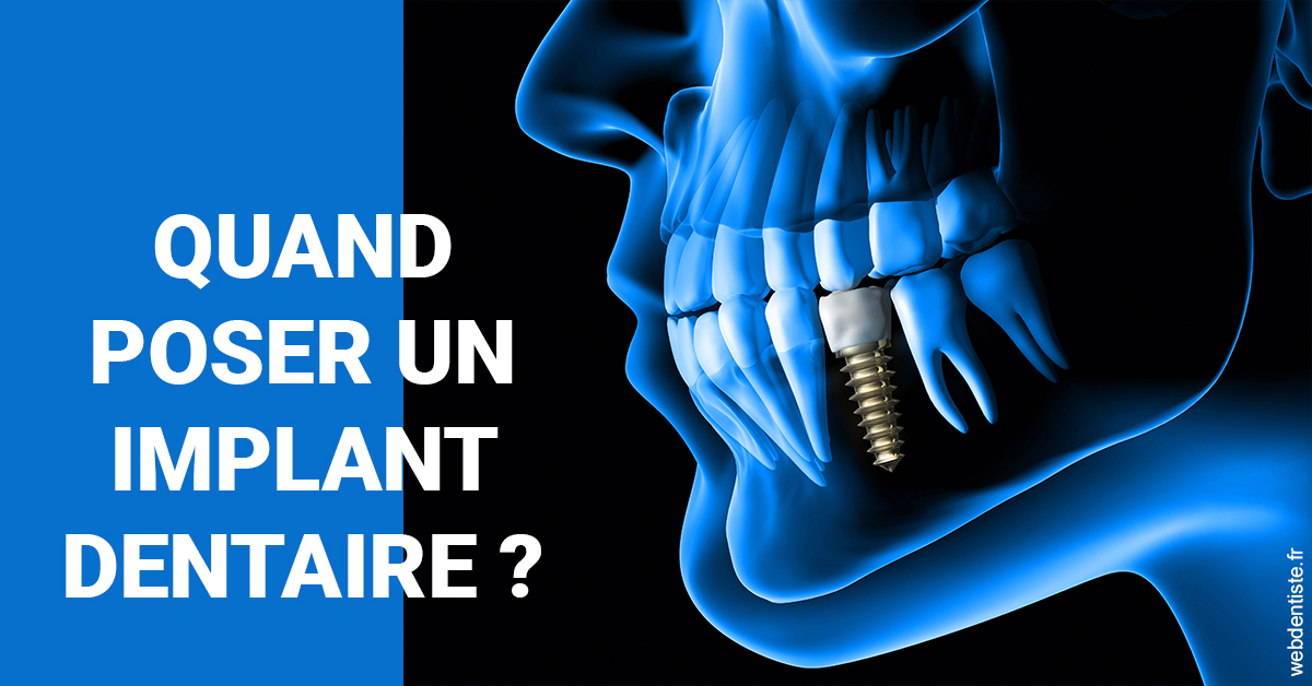 https://www.docteur-lamoureux-jean-claude.fr/Les implants 1