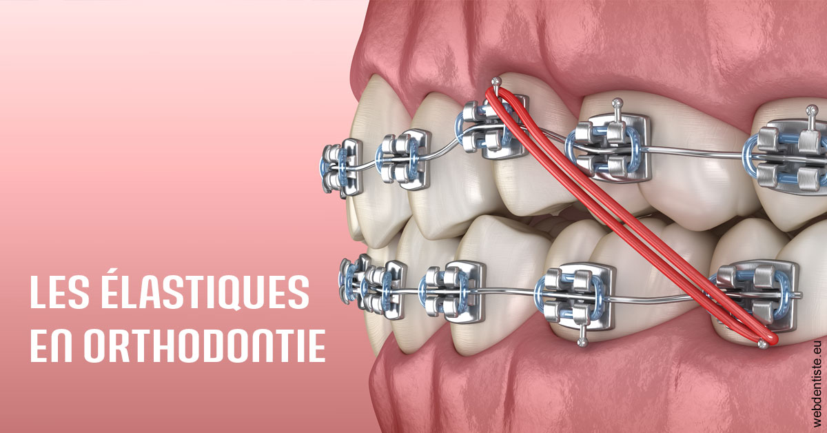 https://www.docteur-lamoureux-jean-claude.fr/Elastiques orthodontie 2